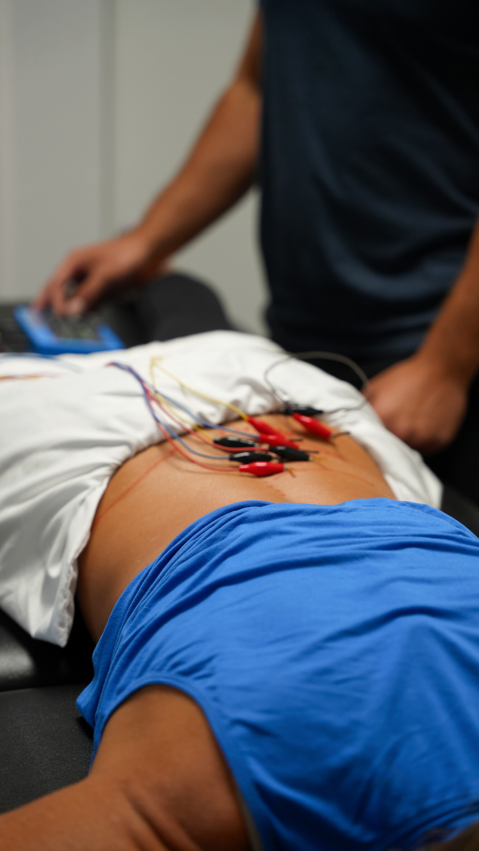 Dry Needling Fort Worth